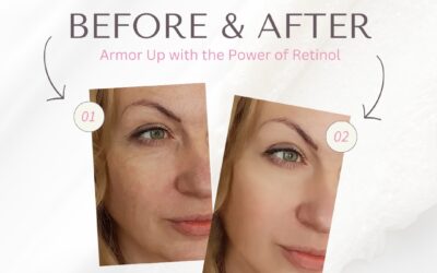 Discover the Remarkable Benefits of Retinol for Your Face
