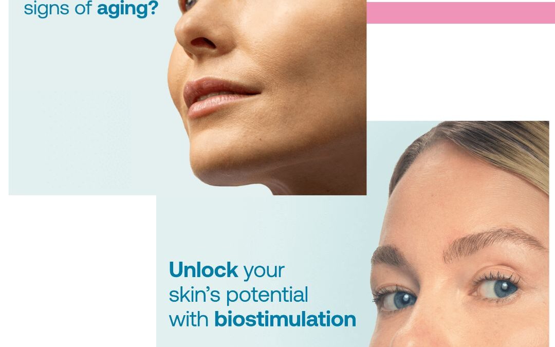 The Power of RADIESSE®: How It Reverses Visible Signs of Aging